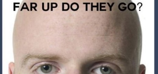 Bald+people_c9e0f2_5477599